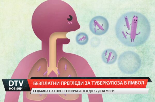 Безплатни прегледи за туберкулоза в Ямбол